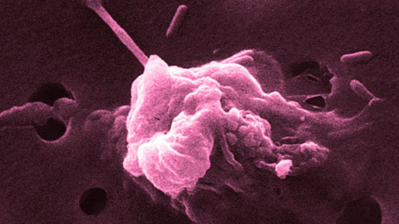 Câncer: as células do tumor morrem por não serem capazes de reparar os danos que os elevados campos elétricos provocam na sua parede celular