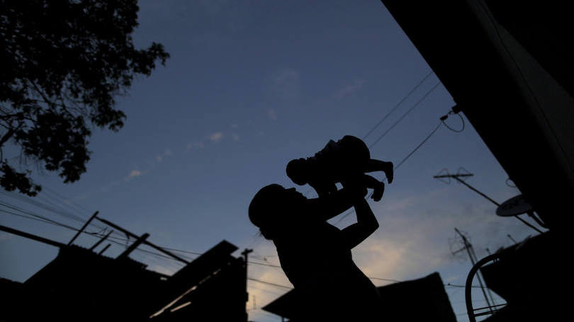 Microcefalia: "Sabíamos que (o bebê) vinha com múltiplas más-formações incompatíveis com a vida"