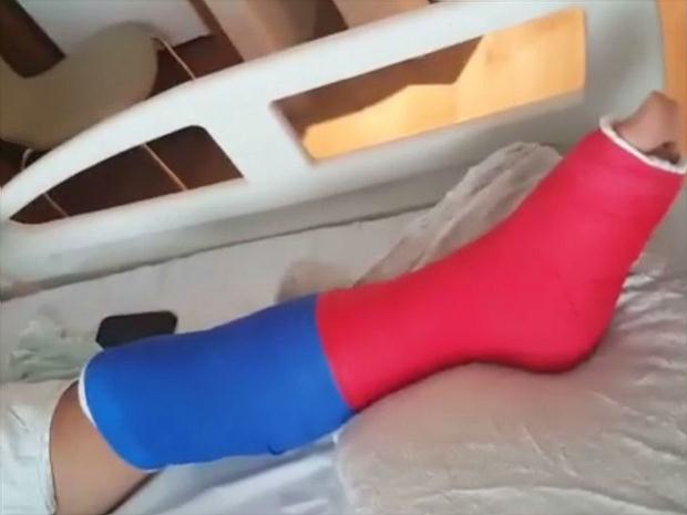 Ginasta pintou seu gesso com as cores da bandeira francesa