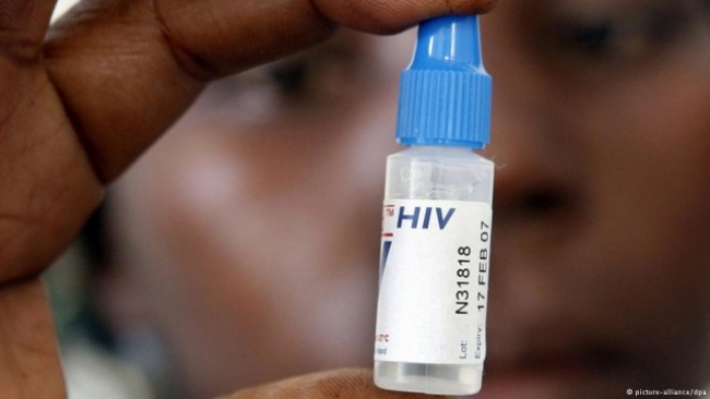 Mais de 36,7 milhões de pessoas, no mundo, estão infectadas por HIV/SIDA.