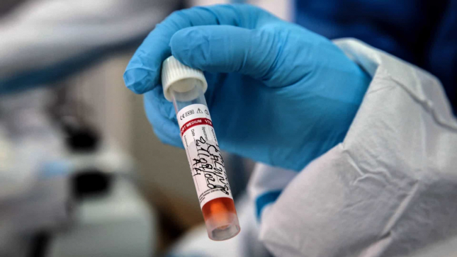 País com mais 8 óbitos, 3.594 novas infecções 1.586 recuperados