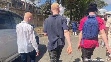 ONG Amor à Vida pede mais apoios para albinos em Nampula