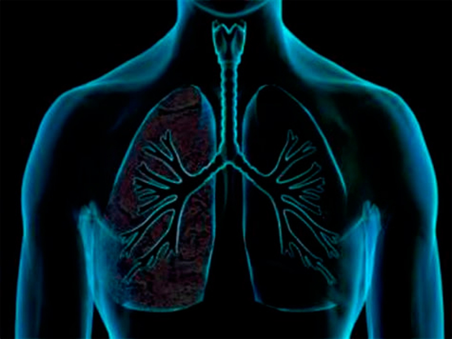 algoritmo, que faz previsões sobre a influência dos tratamentos na evolução do estado de saúde dos pacientes